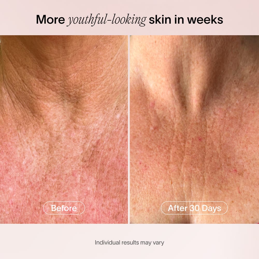 Neck & Chest Rejuvenating Mask